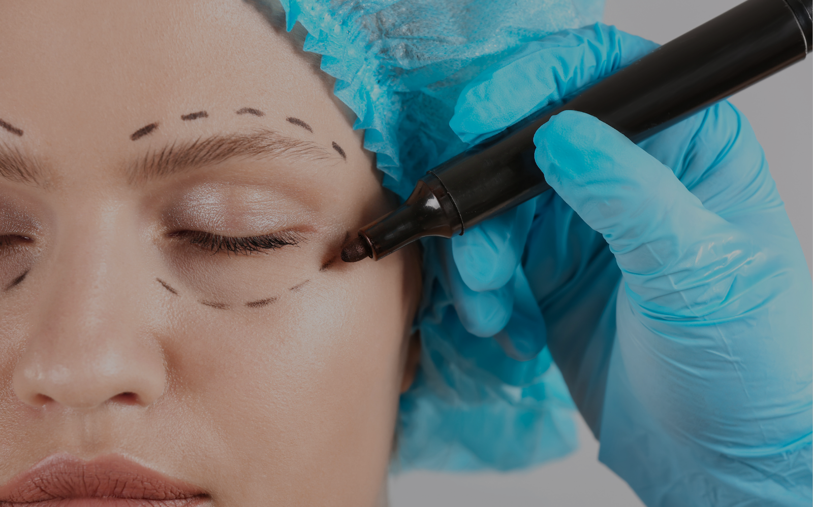 Marcado facial profesional para medicina estética